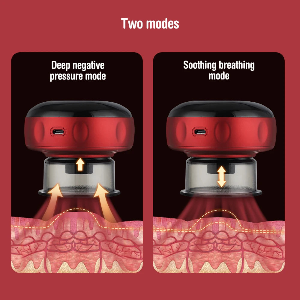 Smart Cupping Massager – Vacuum Suction with Infrared Heating & Red Light Therapy