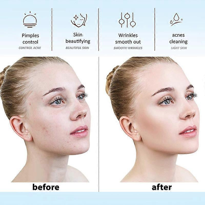 AuraOfRed™ SkinRadiance HF Wand